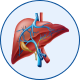 Interventional Oncology for Liver Cancer in Mohali