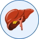 Interventional Oncology for Liver Cancer in Mohali