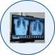 Best Microwave Ablation in Mohali