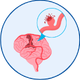 Brain Aneurysm Coiling in Mohali