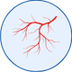 Brain Aneurysm Coiling in Mohali