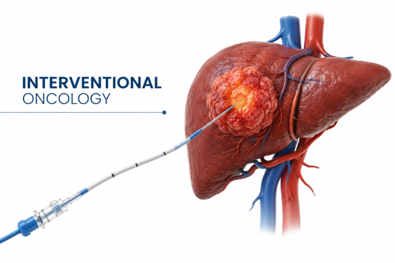 Best Interventional radiologist in mohali