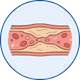 Permacath Placement in Mohali