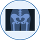 Pelvic Congestion Syndrome Treatment in Mohali