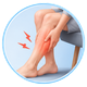Varicose Veins Treatment in Mohali