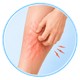Varicose Veins Treatment in Mohali
